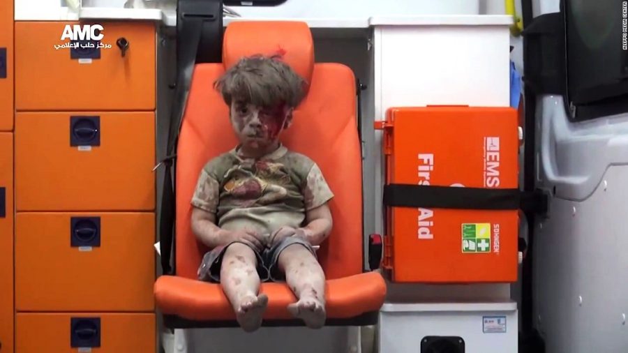 (Picture from CNN) 
Omran Daqneesh in a state of shock in the ambulance. 